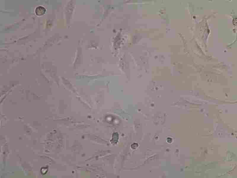 HEC-1-A人子宫内膜腺癌细胞 含STR鉴定