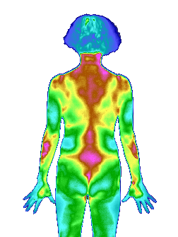 医用红外热像诊断系统的原理