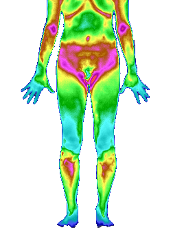 医用红外热像诊断系统的原理
