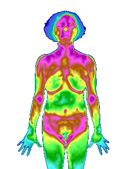 医用红外热像诊断系统的原理