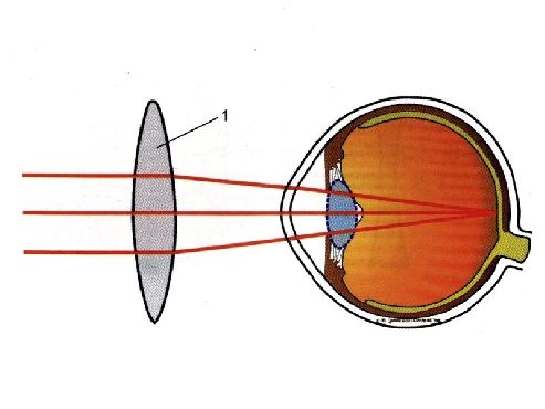验光师关于对远视眼的检查方法