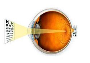 验光师关于对远视眼的检查方法