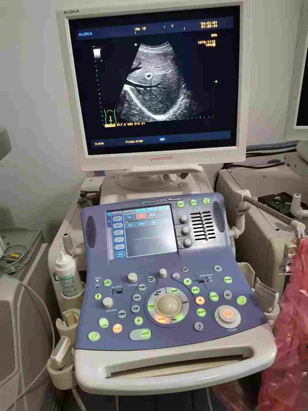 阿洛卡prosound a6彩超售后检测维修中心