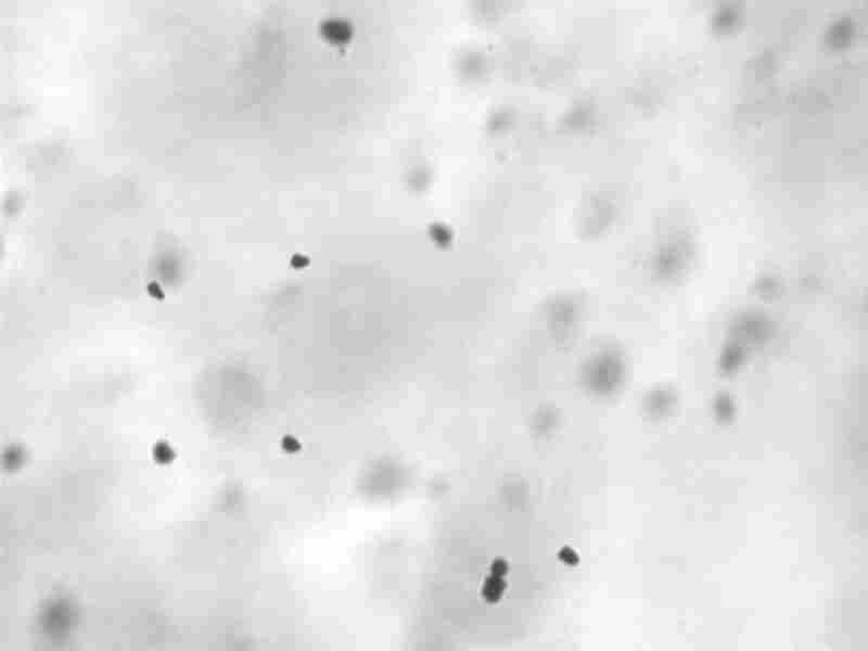 Winner100D动态颗粒图像仪