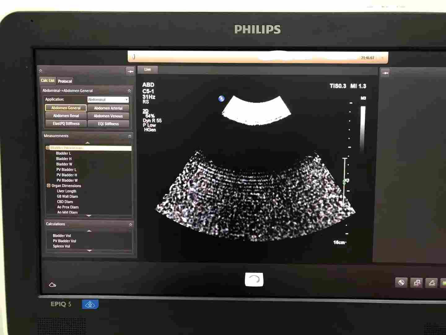 飞利浦彩超EPIQ5雪花状问题维修