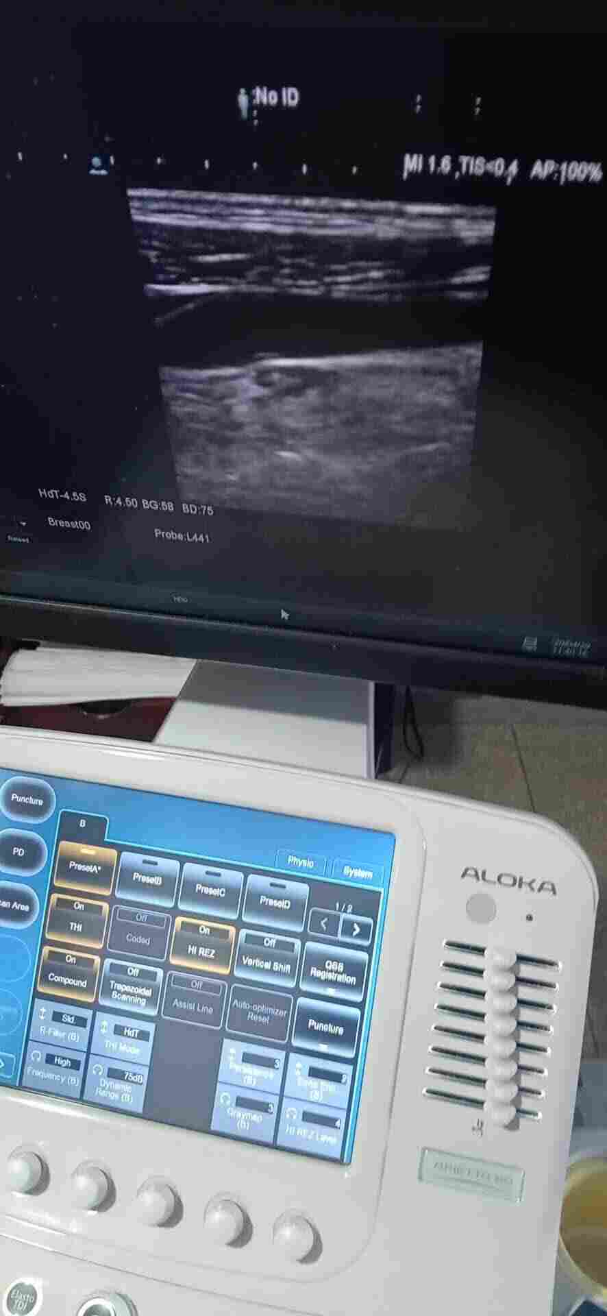 阿洛卡彩超维修维保服务