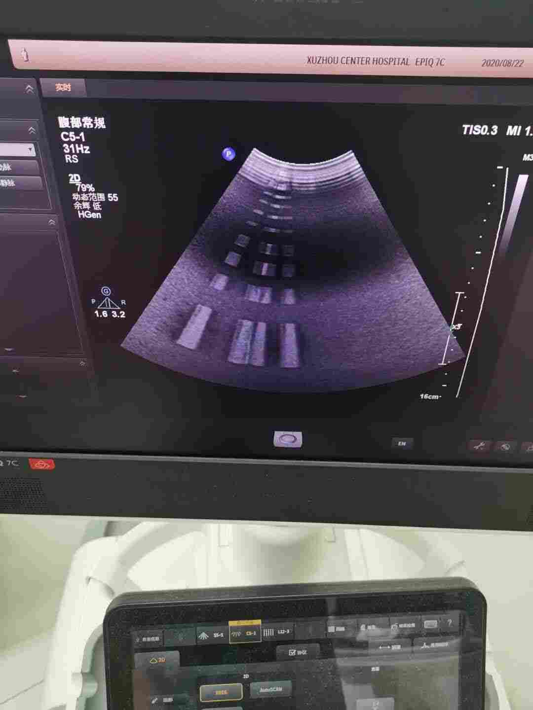 飞利浦彩超维修-彩超常见故障维修-飞利浦系列彩超