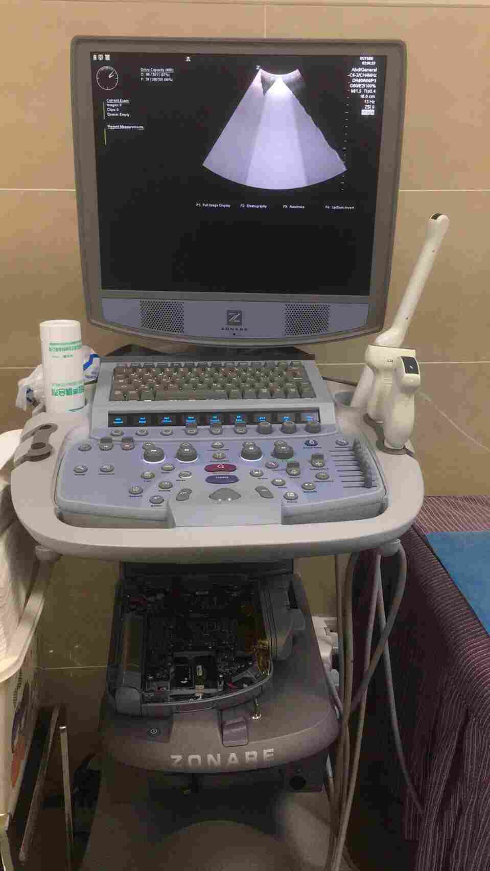 左纳瑞彩色超声多普勒故障维修服务中心