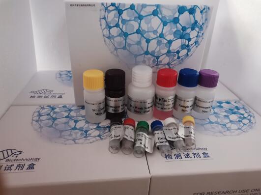 人免疫球蛋白重鏈(IgH)ELISA試劑盒