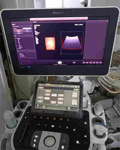 GE彩超维修VolusonE8彩超故障维修