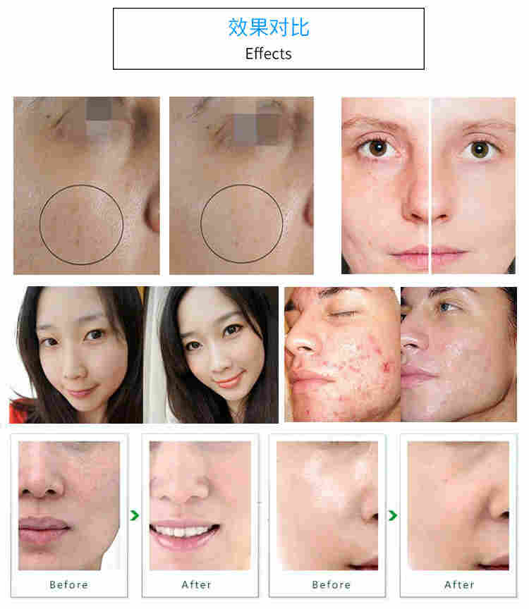 多功能高氧护理仪效果对比图