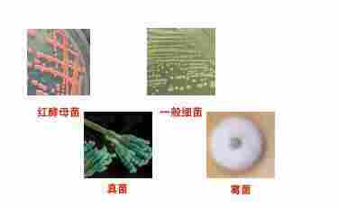 金黄色葡萄球菌