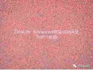 Thp-1细胞高效率转染条件分享