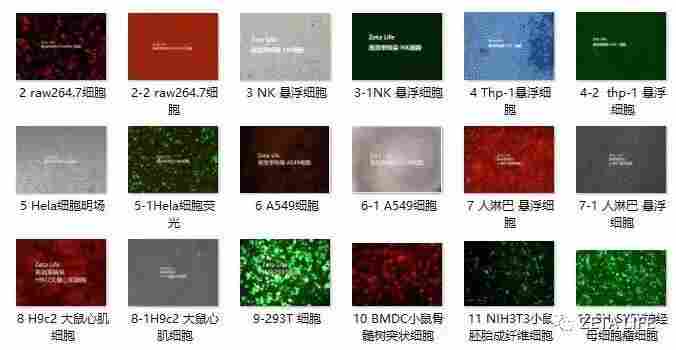 Thp-1细胞高效率转染条件分享