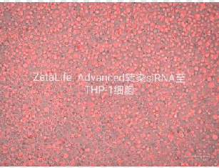 THP-1细胞   siRNA转染