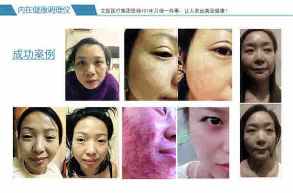 内在健康调理仪效果图