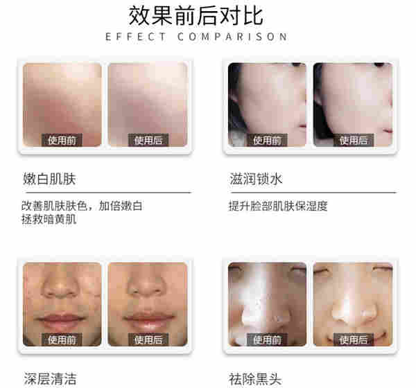 纯氧抗衰仪效果图