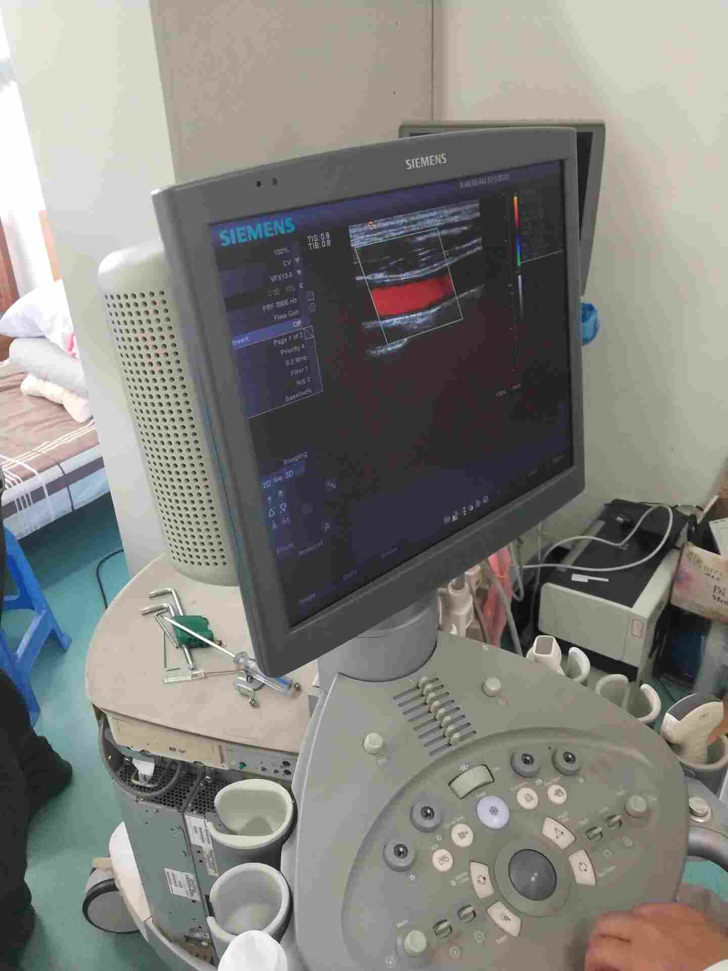 西门子凤凰彩超诊断报错问题技术维修