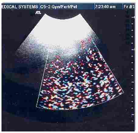 彩超常遇到的干扰故障及排除方法