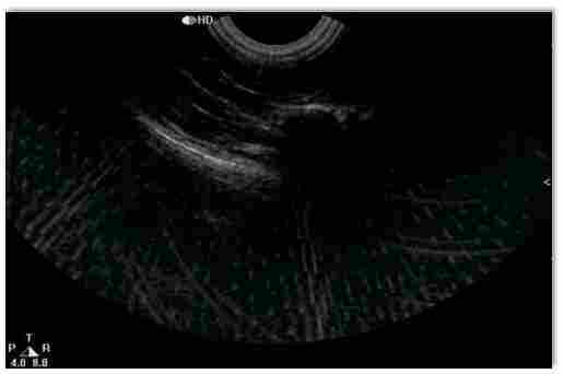 彩超常遇到的干扰故障及排除方法