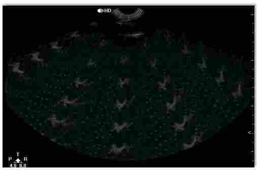 彩超常遇到的干扰故障及排除方法