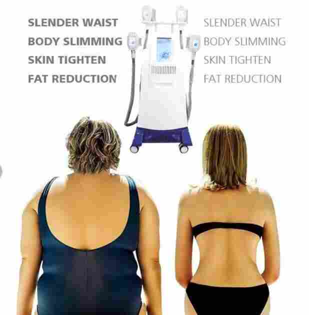 酷塑冷冻减肥仪