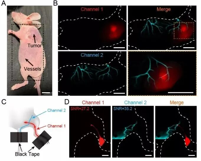 熱點速遞 NIR-II發(fā)光納米材料研究進展解鎖生物醫(yī)學(xué)新應(yīng)用