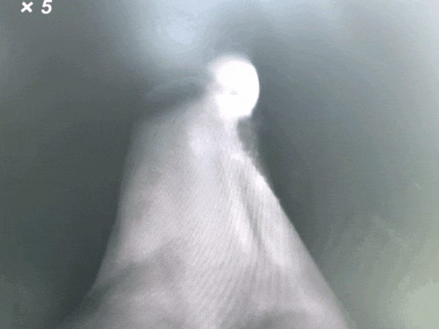 近紅外二區(qū)熒光探針 開啟生物成像新視界