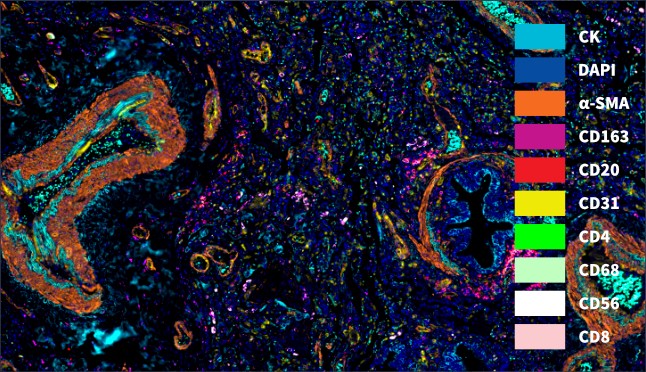 高能TSA多重免疫组化检测试剂盒