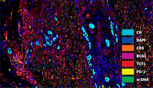 高能TSA多重免疫组化检测试剂盒