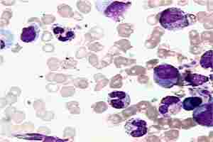 Mouse Galectin-1 ELISA Kit BioAim Scientific