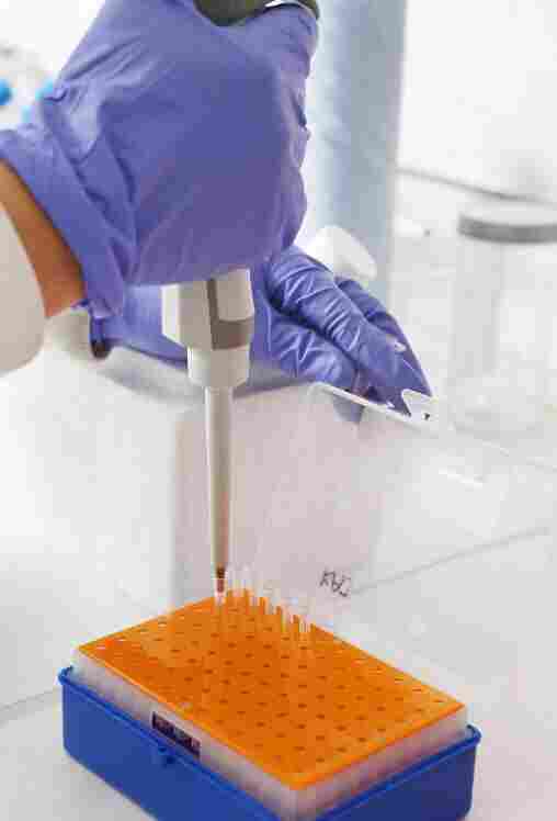 SK-Hep-1(人肝癌细胞)