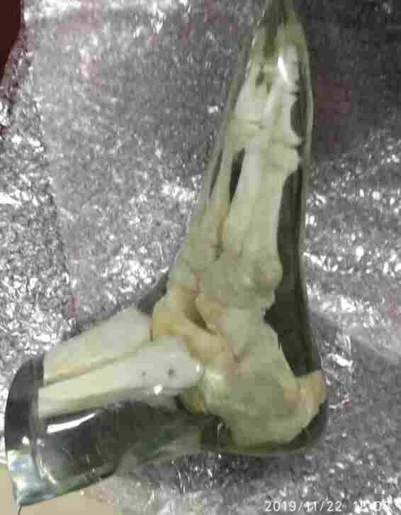 X射線腳部模體-真人骨頭X射線腳部模體產(chǎn)品圖片